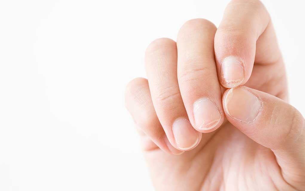 what-your-nails-say-about-your-health-wellness-pursuits